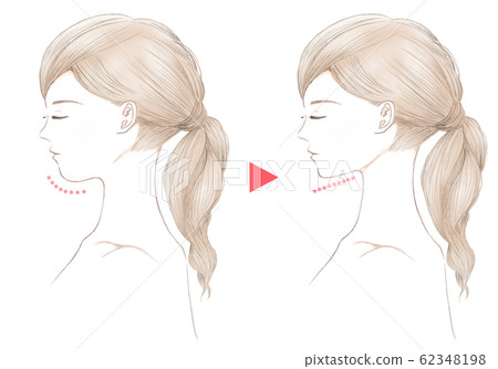 Young woman with closed eyes-double chin-before and after 62348198