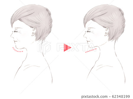 Senior Woman with Closed Eyes-Double Chin-Before After 62348199