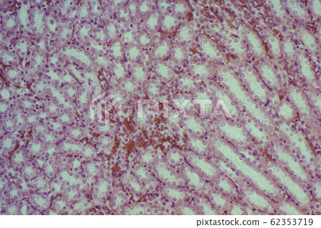 腎臟切片 62353719