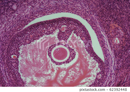Ovarian section micrograph Ovarian section micrograph 62392448
