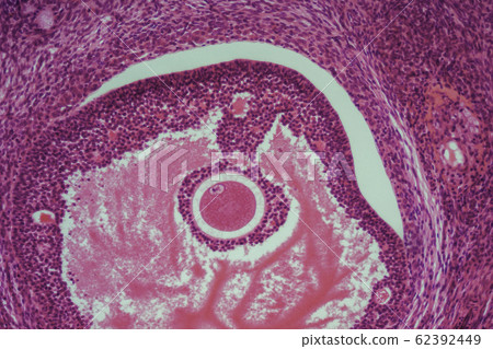 Ovarian section micrograph 62392449