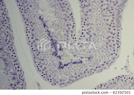 Testicular section micrograph Testicular section micrograph 62392501