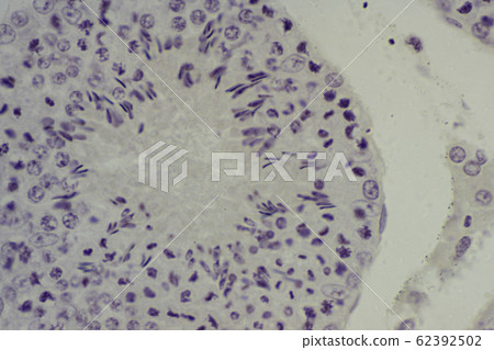 Testicular section micrograph 62392502