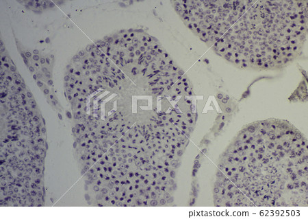 Testicular section micrograph 62392503