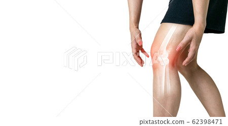 Human leg Osteoarthritis inflammation of bone joints on white background 62398471