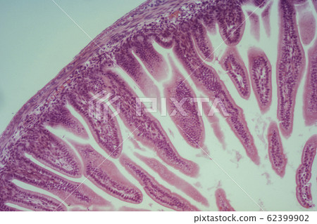 Small intestine section micrograph Small intestine section micrograph 62399902