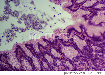 胃部顯微照片 62399995