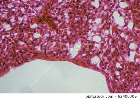 Lung section micrograph 62400309