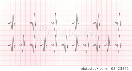 Cardiogram, heartbeat. Electrocardiogram 62423821