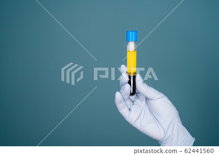 Blood plasma in vitro gloved hand holding Blood plasma in vitro gloved hand holding 62441560