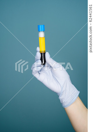 Blood plasma in vitro gloved hand holding Blood plasma in vitro gloved hand holding 62441561