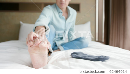 man with athlete foot 62464914