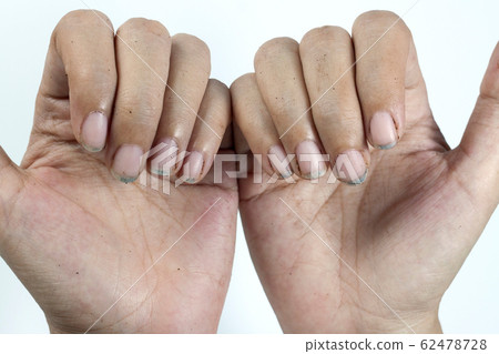 Dirty nails, dirty with dirt lodged in the nails 62478728