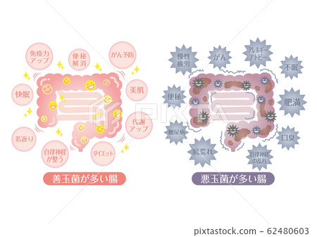 Intestine illustration Intestine with lots of good bacteria Intestine with lots of bad bacteria 62480603