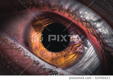 Extreme detail of human pupil or yey iris. Redness of the eyes in humans. Inflamed conjunctiva of the eyeball. Fury in the eyes of a man. 62488821