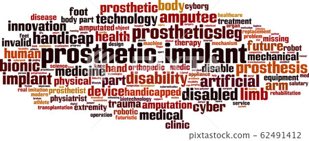 Prosthetic implant word cloud Prosthetic implant word cloud 62491412