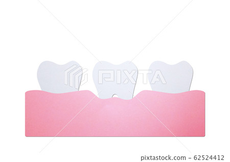 periodontitis or gum disease, dental problem periodontitis or gum disease, dental problem 62524412