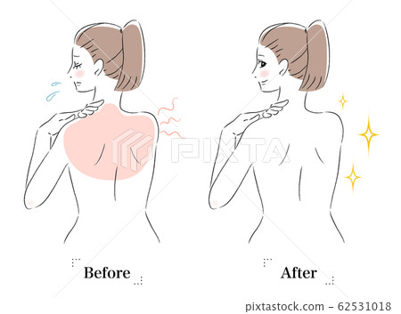 Back skin worries tanned before after women Back skin worries tanned before after women 62531018