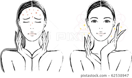 Female acne before and after 62538947