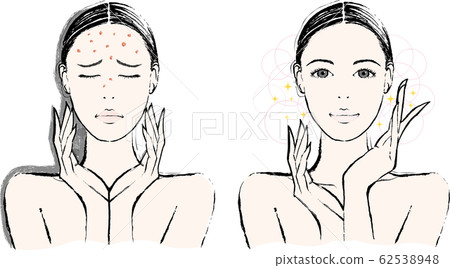 Female acne before and after 62538948
