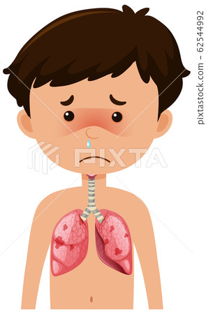 Sick boy from coronavirus with pneumonia Sick boy from coronavirus with pneumonia 62544992