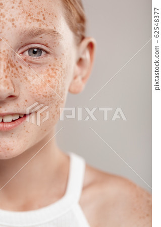 Inclusive Beauty. Girl with freckles standing isolated on grey half face close-up smiling happy Inclusive Beauty. Girl with freckles standing isolated on grey half face close-up smiling happy 62548377