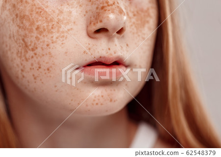 Inclusive Beauty. Girl with freckles standing isolated on grey lips close-up Inclusive Beauty. Girl with freckles standing isolated on grey lips close-up 62548379