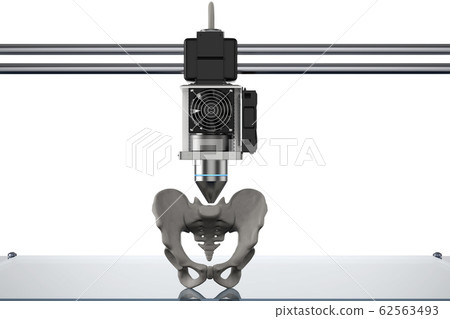 3d printer print prosthetic hip bone 62563493