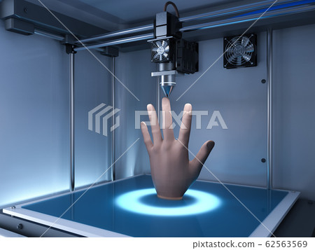 3d printer print prosthetic hand 62563569