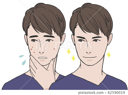 Clear acne skin! Clear acne skin! 62590019