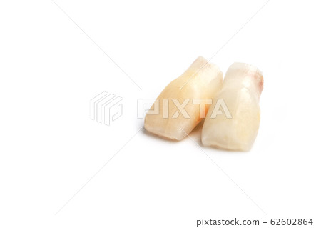 Baby teeth on a white background. Loss of two Baby teeth on a white background. Loss of two 62602864