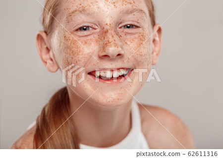 Inclusive Beauty. Girl with freckles standing isolated on grey laughing cheerful close-up 62611316