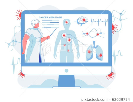 Doctor Showing Cancer Metastasis Flat Illustration Doctor Showing Cancer Metastasis Flat Illustration 62639754
