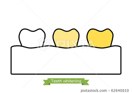 white to yellow tooth, teeth whitening before and after concept white to yellow tooth, teeth whitening before and after concept 62640810