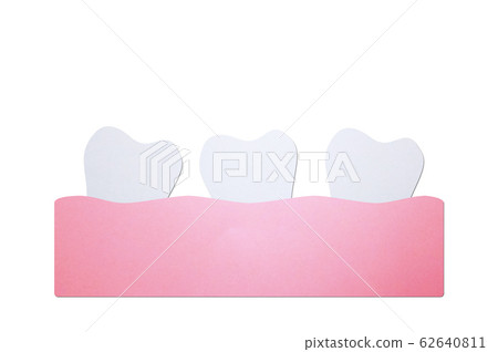 crowding teeth (malocclusion) or crooked teeth, dental problem crowding teeth (malocclusion) or crooked teeth, dental problem 62640811