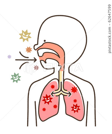 Infectious disease pneumonia cute system Infectious disease pneumonia cute system 62647599