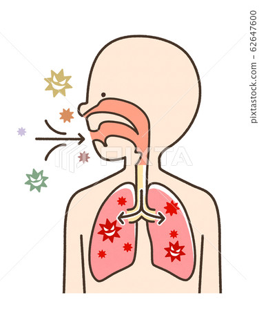 傳染病肺炎可愛系統 62647600