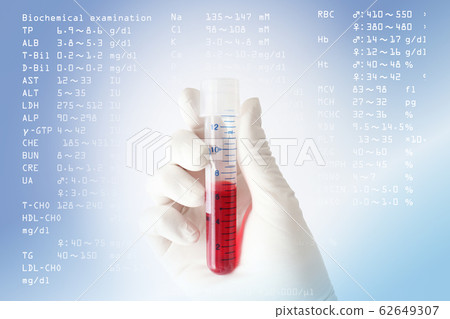 Medical image blood test 62649307