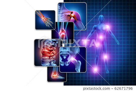 Joint Body Pain 62671796