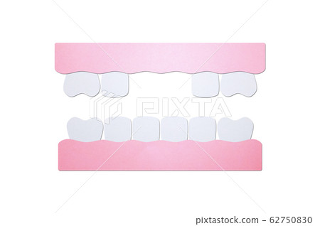 model tooth of missing teeth 62750830