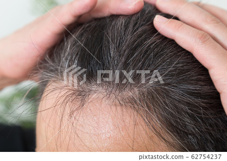 Male hair Male hair 62754237
