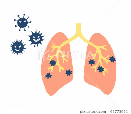 Pneumonia pulmonary tuberculosis 62773031