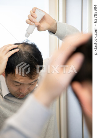 中年男子遭受稀薄的頭髮 62788994