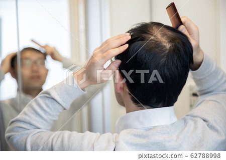 Middle aged man suffering thin hair 62788998