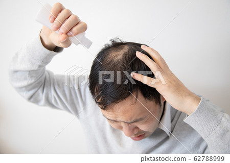 中年男子遭受稀薄的頭髮 62788999