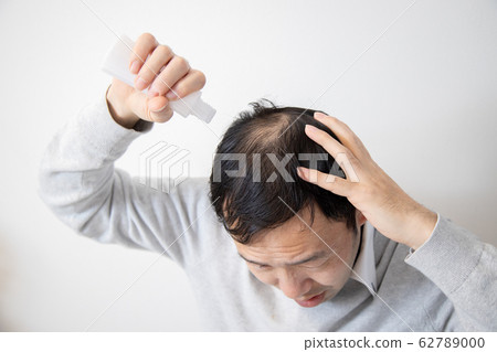 中年男子遭受稀薄的頭髮 62789000