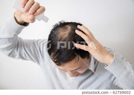 Middle aged man suffering thin hair Middle aged man suffering thin hair 62789002
