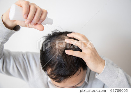 中年男子遭受稀薄的頭髮 62789005