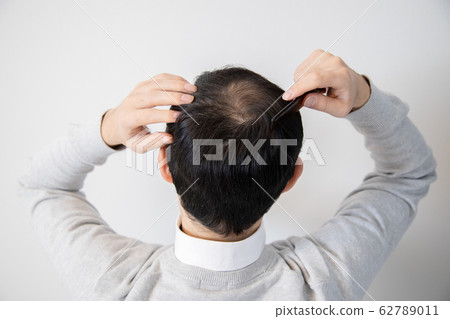 中年男子遭受稀薄的頭髮 62789011