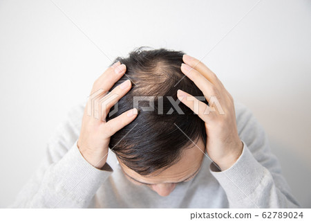 Middle aged man suffering thin hair 62789024